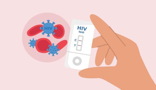 Jharkhand High Court Orders Framing of Guidelines for HIV Testing and Treatment of Prisoners